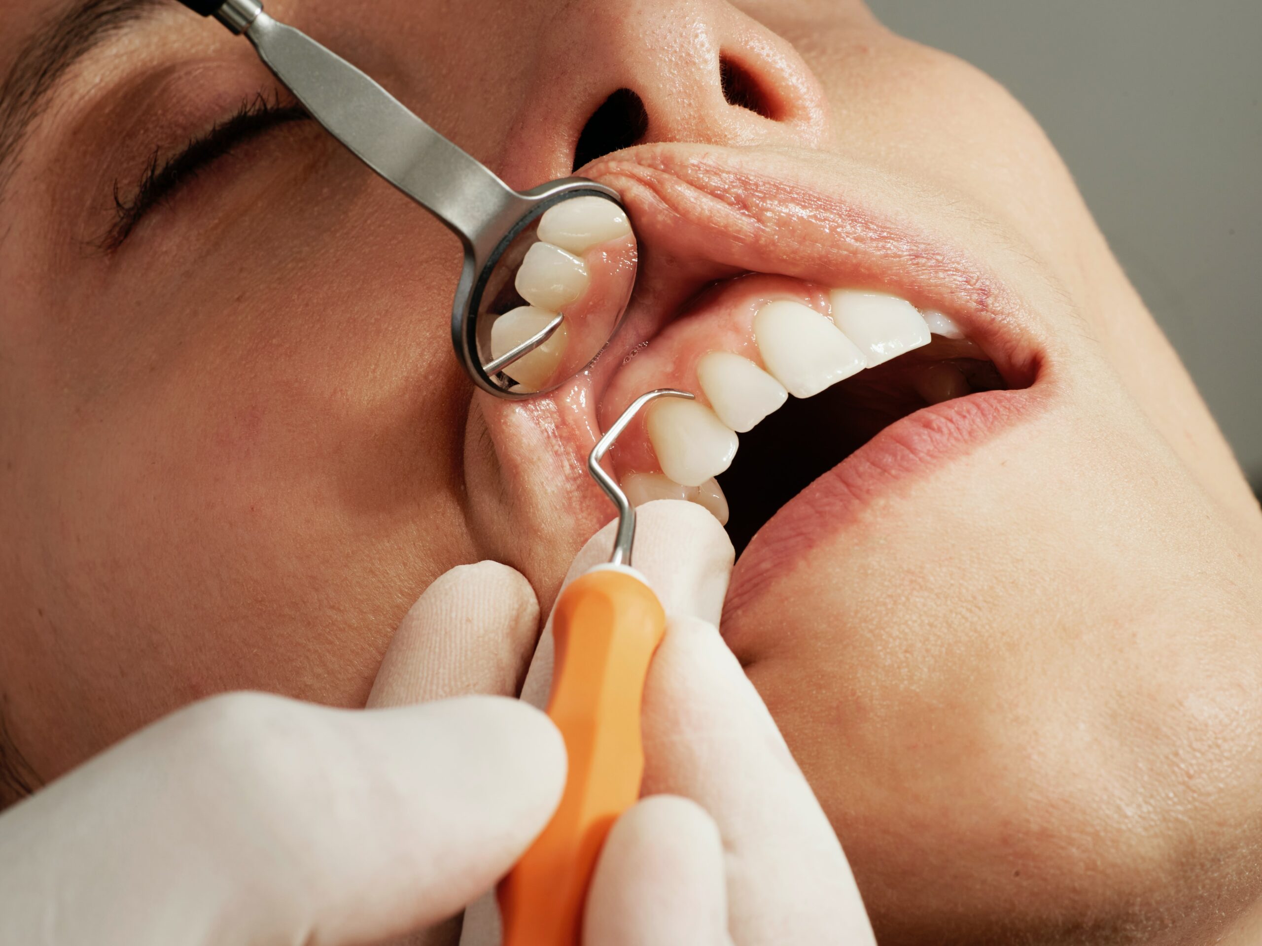 orthodontie afspraak